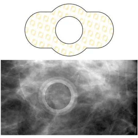 Precision Dynamics - Spee-D-Ring - SDG-M612 - Skin Marker Spee-D-Ring Yellow / White 0.5 Inch Inside Ø