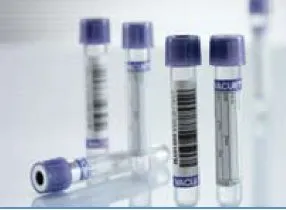 Greiner Bio-One - Vacuette - 454209 -  VACUETTE Venous Blood Collection Tube K2 EDTA Additive 13 X 75 mm 4 mL Lavender / Black Ring Pull Cap Polyethylene Terephthalate (PET) Tube