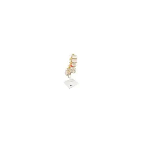 American 3B Scientific - From: A76 To: A76/5 - Lumbar Spinal Column w. dorso