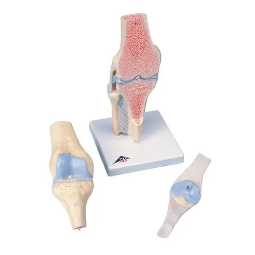 American 3B Scientific - A89 - Sectional knee joint model