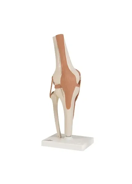 Fabrication Enterprises - Dec-11 - Functional Knee Joint Model