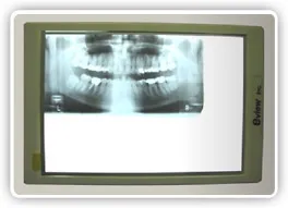Dent Corp - 600 - E-View X-Ray Viewer
