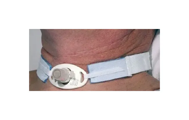 Vyaire Medical - Airlife - Res242a - Tracheostomy Tube Holder Airlife Neonatal / Pediatric