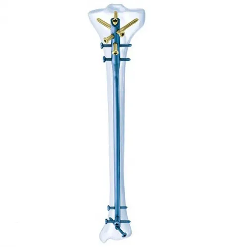 Synthes - 04.004.558S - SYNTHES 11MM TI CANNULATED TIBIAL NAIL-EX/390MM-STERILE