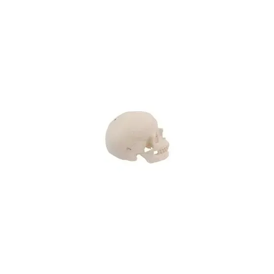 American 3B Scientific - From: XA022 To: XA023 - Skeleton: Skull with hole A10,A10/5,A